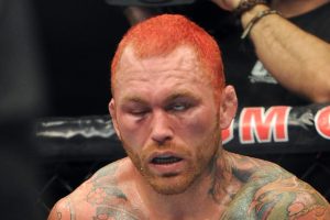 UFC Veteran Chris Leben comes out of retirement to fight Phil Baroni in a Bare Knuckle Boxing match - Knuckle