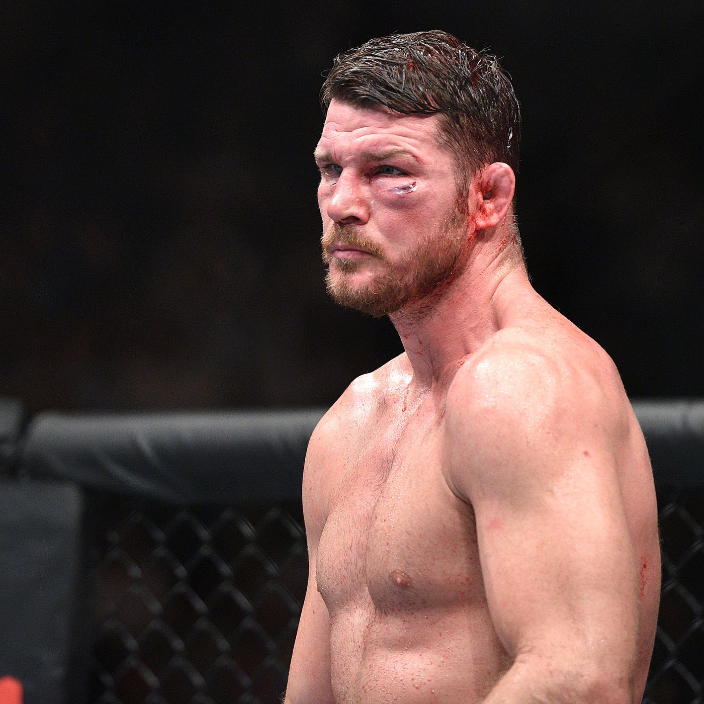Michael Bisping reveals that he fought a lot of his career 'clinically blind' -
