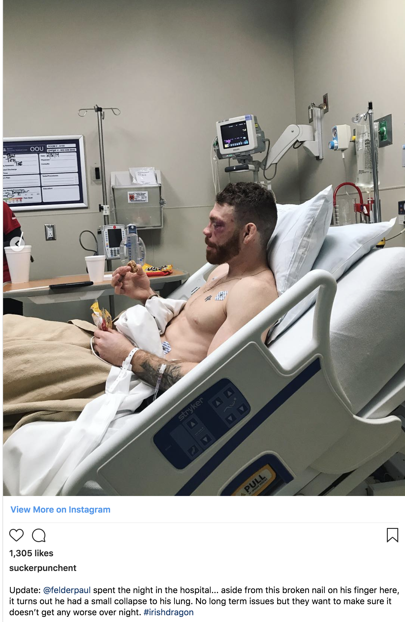 Paul Felder suffered collapsed lung late in UFC Phoenix win over James Vick -